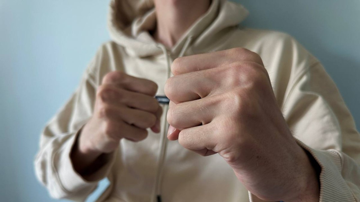 Под Самарой мужчина сломал приятелю лицевые кости и повредил череп