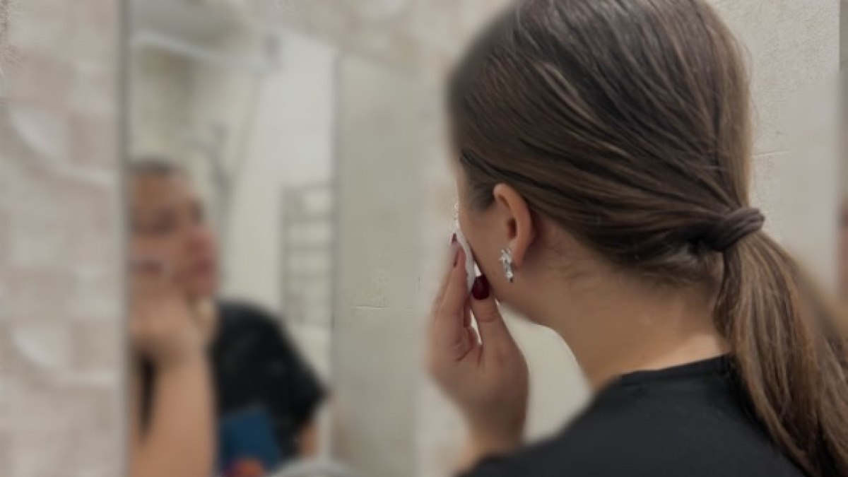 Врач Жирнов назвал самарцам ошибки, которые старят кожу в морозы