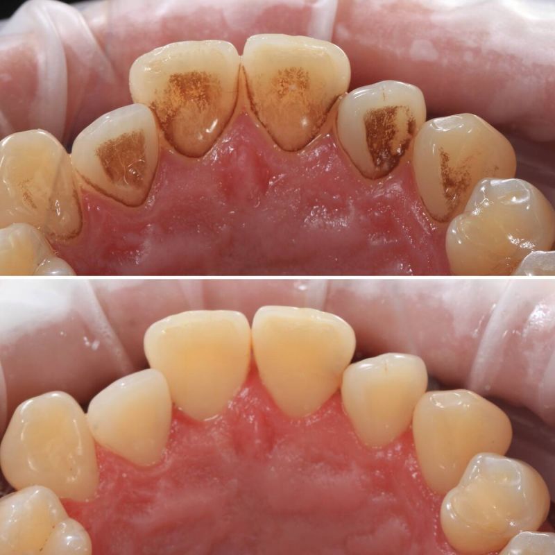 ����� �� �����: ��� ��������� ������ ��������