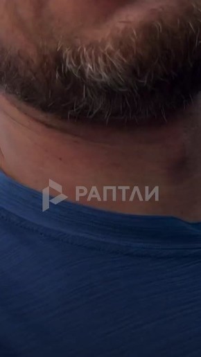 ��� ����� ���-�� 5 ��������, ����������� ���� � 2�: ��������� ���������� ������� �����������