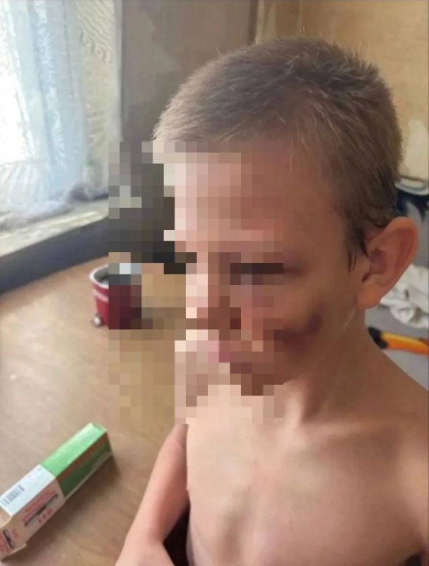 Многодетный отец избил девятилетнего сына в Самаре — мальчика госпитализировали Многодетный отец избил девятилетнего сына в Самаре — мальчика госпитализировали