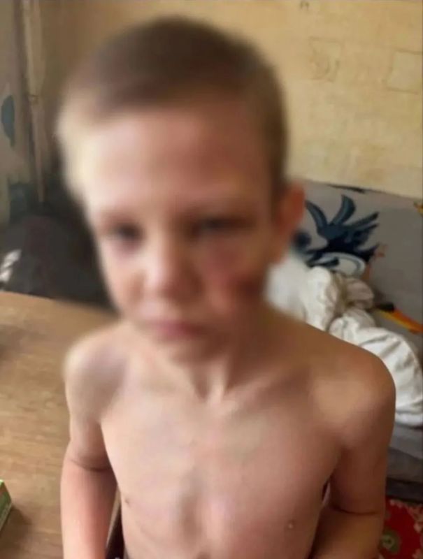 Марина Ахмедова: Прямо задела эта ситуация. Отец систематически избивал 9-летнего сына в Самаре