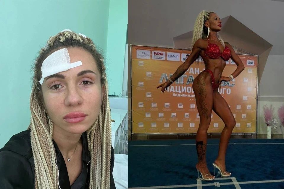 Почти ослепла, но не отказалась от своей мечты: самарчанка участвует в конкурсах фитнес-бикини, несмотря на тяжелую болезнь