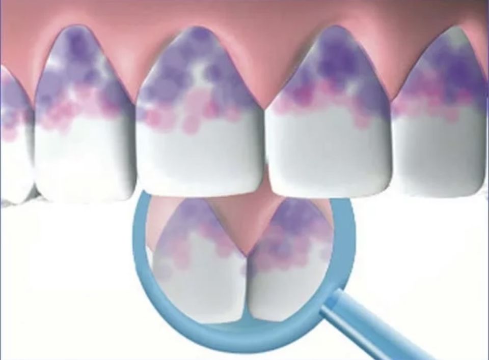 ��� ���������� ������� ������ �������� ��������� �������� ������