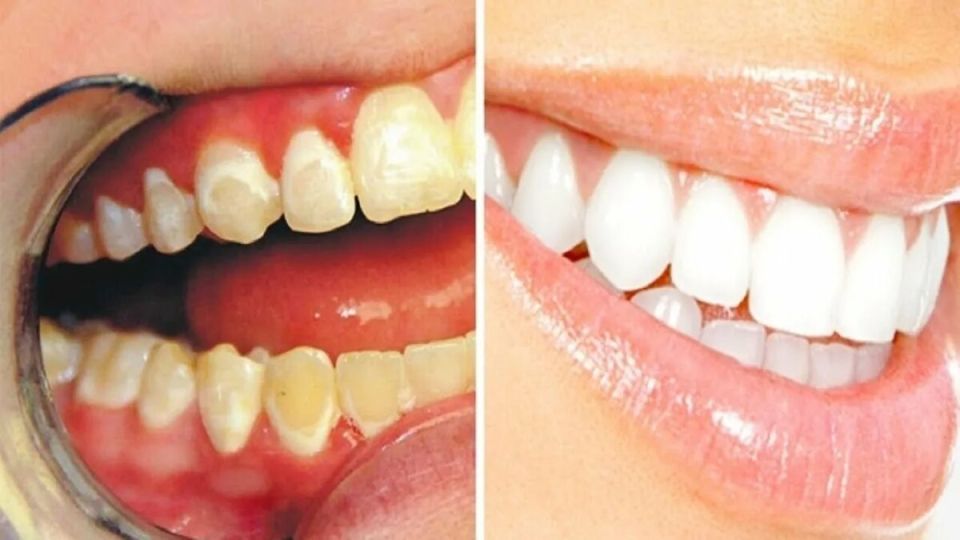 ��� ������������� ������ �����?